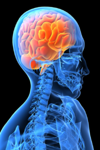Claims for Brain Injury
