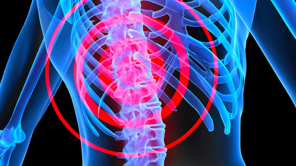 Spinal Cord Injury Claims